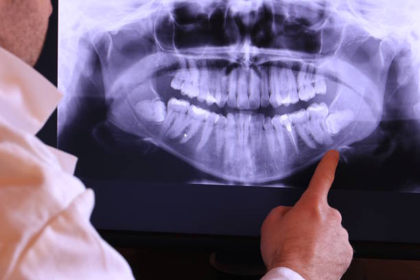 Best Emergency Root Canal Treatment in Mount Airy, MD