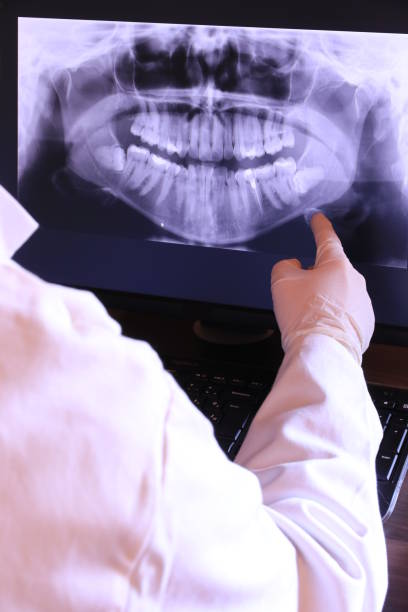 Best Emergency Tooth Extraction in Mount Airy, MD