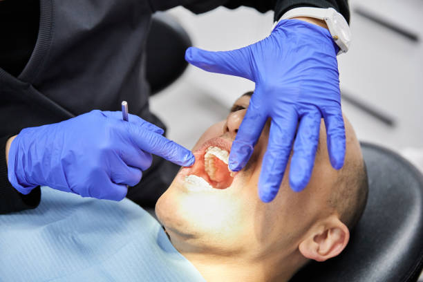 Best Emergency Denture Repair in Mount Airy, MD