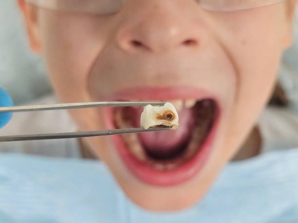 Best Pediatric Emergency Dentist in Mount Airy, MD